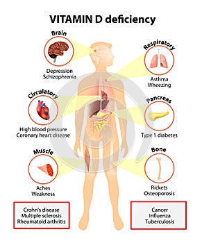 Vitamina. síntomas a enfermedades 