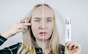 Vitamin A, Retinol, Niacinamide, Vitamin C. Girl smears her face with antioxidant anti-wrinkle cream. Anti-aging and facial