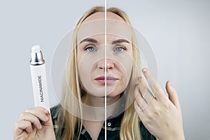 Vitamin A, Retinol, Niacinamide, Vitamin C. Girl smears her face with antioxidant anti-wrinkle cream. Anti-aging and facial