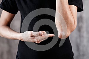 Vitiligo on hands and elbows with black background