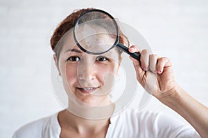 Vitiligo. Portrait of a beautiful woman with lack of skin pigmentation on her forehead with a magnifier in her hands. A