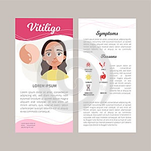 Vitiligo vector infographics.