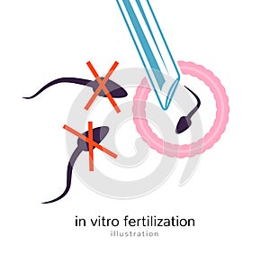 In vitro fertilisation icon. Biological insemination isolated medical infertility health vitro pregnancy