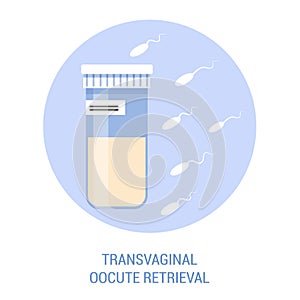 In vitro fertilisation step. Removing oocyte from the ovary