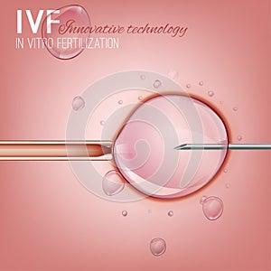 In Vitro Fertilization