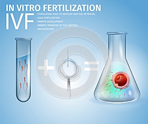 In Vitro Fertilization Formula and Stages Banner photo