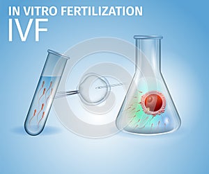 Methods of Infertility Treatment, IVF, Egg, Sperm photo
