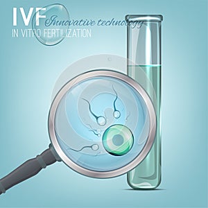 In Vitro Fertilization image