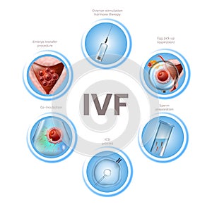 In Vitro Fertilization Infographics Round Icons