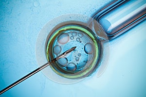 In vitro fertilization, IVF concept photo