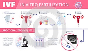 In Vitro Fertilization IVF Flat Infographics