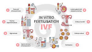 In Vitro fertilization IVF vector circle infographic and infertility treatment