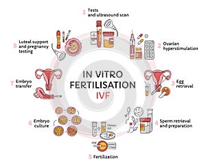 In Vitro fertilization IVF vector circle infographic and infertility treatment