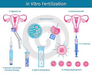In Vitro Fertilization Process Concept