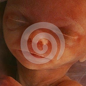 In vitro image of a human fetus in the womb