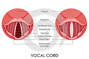 Vocale cordone 