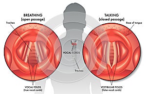 Vocal cords