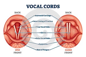 Vocal cords labeled anatomical and medical structure and location scheme