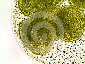 Volvox algae under microscope - 400x photo