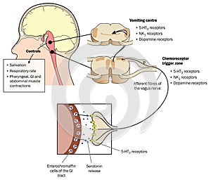 The vomiting reflex