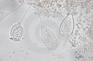 Vorticella