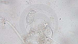 Vorticella is a genus of protozoan