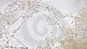 Vorticella is a genus of protozoan