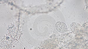 Vorticella is a genus of protozoan