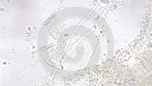 Vorticella is a genus of protozoan