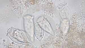 Vorticella is a genus of protozoan