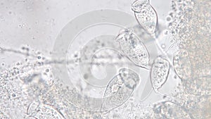 Vorticella is a genus of protozoan