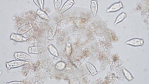 Vorticella is a genus of protozoan