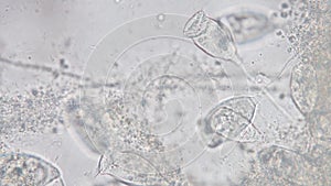 Vorticella is a genus of protozoan