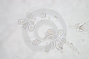 Vorticella is a genus of protozoan