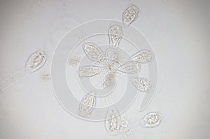 Vorticella is a genus of protozoan