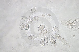 Vorticella is a genus of protozoan photo