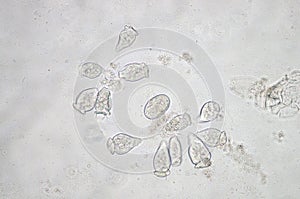 Vorticella is a genus of protozoan