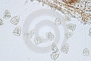 Vorticella is a genus of protozoan under microscope photo