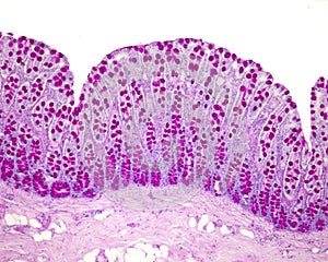 Colon mucosa. Goblet cells photo