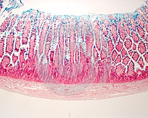 Goblet cells. Intestinal epithelium photo