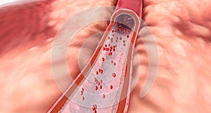 The walls of arteries contain three layers. Endothelium, a middle muscular layer, and an outer elastic layer