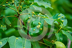 Walnuts on a tree. Disease pest on walnut leaves. Eriophyes tristriatus Nal or Nutty gall mite.