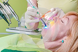 Wand that emits blue light is used to cure the resin within dental patient mouth