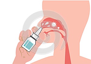 Wash the dirt from the nose. Nasal saline injections, cold and flu season, including coronavirus. Flat style cartoon illustration