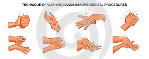 Washing hands before medical procedures
