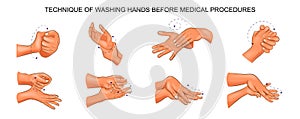 Washing hands before medical procedures photo