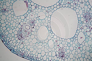 Water lily nymphaea stem under the microscope