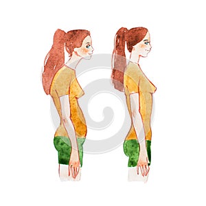 Watercolor illustration of people with right and wrong posture. Woman with normal healthy spine and abnormal sick spine