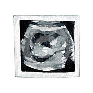 Watercolor pregnant ultrasound clipart illustration