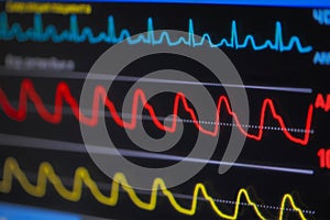 Waves ECG on monitor in perspective